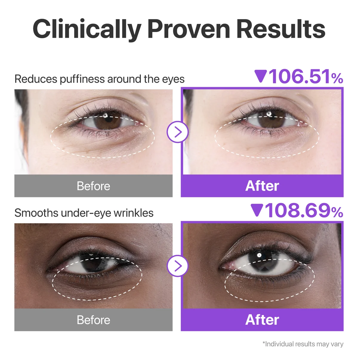 Numbuzin Collagen Under Eye Patches - 5pairs - Image 2
